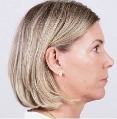 Bernafon Alpha XT  miniBTE T R, Kulak Arkası Şarj edilebilir İşitme Cihazı Bernafon Şarjlı Kulak Cihazı Alpha XT  miniBTE T R